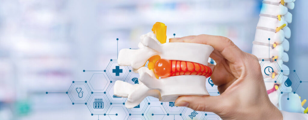 How to Tell if a Herniated Disc is the Reason for Your Back Pain