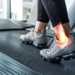 Plantar Fasciitis: The Most Common Cause of Heel Pain Revealed!