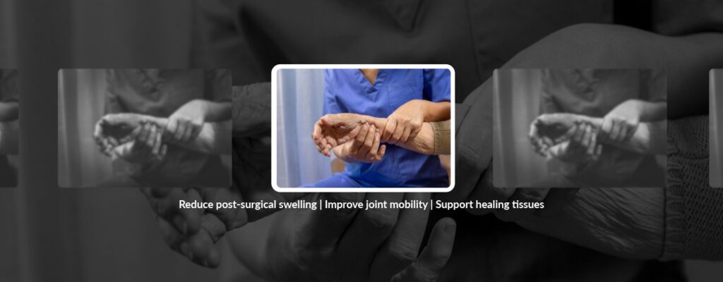 Managing Post-Op Swelling Through Physical Therapy Treatment